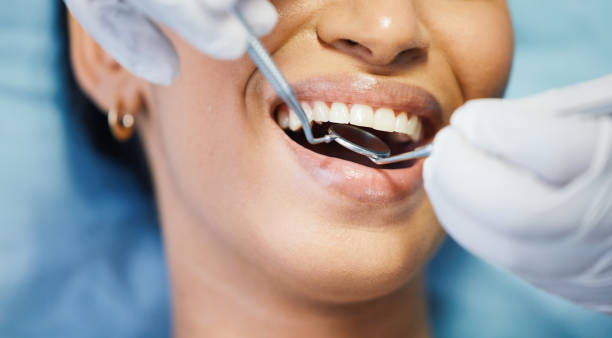 Best Emergency Root Canal Treatment in Solomons, MD